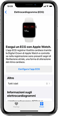 Apple Watch configurazione ECG