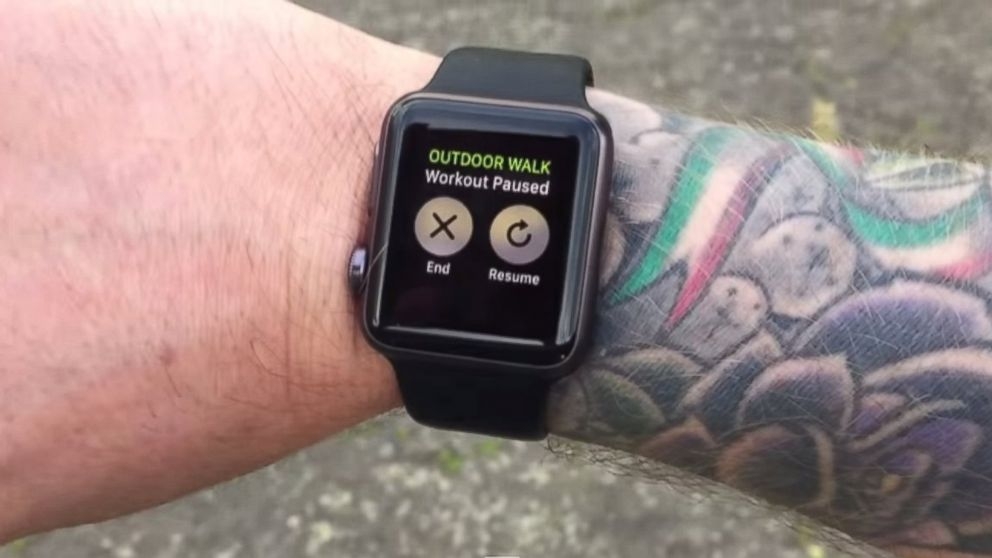 Perché i tatuaggi interferiscono con L'Apple Watch